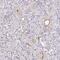 DENN Domain Containing 5A antibody, PA5-62705, Invitrogen Antibodies, Immunohistochemistry frozen image 