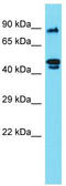 Radial Spoke Head Component 4A antibody, TA332269, Origene, Western Blot image 