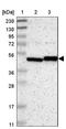 Leucine-rich repeat, immunoglobulin-like domain and transmembrane domain-containing protein 3 antibody, NBP1-83895, Novus Biologicals, Western Blot image 