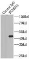Proteasome 26S Subunit, Non-ATPase 11 antibody, FNab06883, FineTest, Immunoprecipitation image 