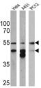 Cytokeratin Pan  antibody, MA5-12231, Invitrogen Antibodies, Western Blot image 