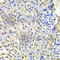 Small Nuclear Ribonucleoprotein D2 Polypeptide antibody, A6983, ABclonal Technology, Immunohistochemistry paraffin image 