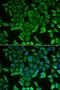 Arginyl-TRNA Synthetase antibody, LS-C334629, Lifespan Biosciences, Immunofluorescence image 