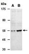 MDM2 Proto-Oncogene antibody, orb67283, Biorbyt, Western Blot image 