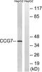 Calcium Voltage-Gated Channel Auxiliary Subunit Gamma 7 antibody, LS-C120465, Lifespan Biosciences, Western Blot image 