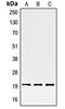 Serine And Arginine Rich Splicing Factor 3 antibody, MBS821030, MyBioSource, Western Blot image 