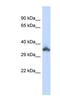 Keratin Associated Protein 24-1 antibody, NBP1-91600, Novus Biologicals, Western Blot image 