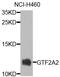 N-Acetyltransferase 9 (Putative) antibody, orb373567, Biorbyt, Western Blot image 