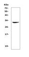 HLA class II histocompatibility antigen, DQ beta 1 chain antibody, A00106-1, Boster Biological Technology, Western Blot image 