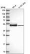 DnaJ Heat Shock Protein Family (Hsp40) Member A4 antibody, PA5-65311, Invitrogen Antibodies, Western Blot image 