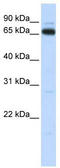 Kelch repeat and BTB domain-containing protein 5 antibody, TA345540, Origene, Western Blot image 