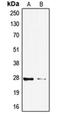 Tumor Protein P53 Inducible Nuclear Protein 1 antibody, orb215345, Biorbyt, Western Blot image 