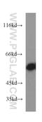 Src Kinase Associated Phosphoprotein 1 antibody, 19247-1-AP, Proteintech Group, Western Blot image 