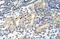 MLX Interacting Protein Like antibody, A03145, Boster Biological Technology, Immunohistochemistry frozen image 
