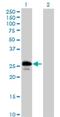 Ubiquitin-conjugating enzyme E2 J2 antibody, H00118424-B01P, Novus Biologicals, Western Blot image 