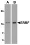 Steroid Receptor Associated And Regulated Protein antibody, A31838, Boster Biological Technology, Western Blot image 