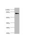 Mannosyl (Alpha-1,3-)-Glycoprotein Beta-1,2-N-Acetylglucosaminyltransferase antibody, LS-C676046, Lifespan Biosciences, Western Blot image 