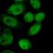 Neurofibromin 1 antibody, FNab09869, FineTest, Immunofluorescence image 