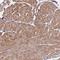 Bone Marrow Stromal Cell Antigen 1 antibody, NBP2-14363, Novus Biologicals, Immunohistochemistry frozen image 