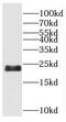 RB Binding Protein 9, Serine Hydrolase antibody, FNab07154, FineTest, Western Blot image 