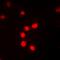 Fms Related Tyrosine Kinase 4 antibody, orb373289, Biorbyt, Immunocytochemistry image 
