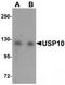 Ubiquitin Specific Peptidase 10 antibody, TA319768, Origene, Western Blot image 