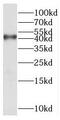 Xyloside Xylosyltransferase 1 antibody, FNab01106, FineTest, Western Blot image 
