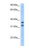 Potassium Channel Regulator antibody, NBP1-80108, Novus Biologicals, Western Blot image 