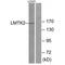 Serine/threonine-protein kinase LMTK2 antibody, PA5-49847, Invitrogen Antibodies, Western Blot image 