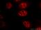 Forkhead Box O3 antibody, 66428-1-Ig, Proteintech Group, Immunofluorescence image 