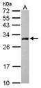 Adaptor Related Protein Complex 3 Subunit Mu 2 antibody, NBP2-15419, Novus Biologicals, Western Blot image 