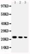 TNF Superfamily Member 13b antibody, PA1541, Boster Biological Technology, Western Blot image 