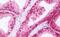 Retinoic Acid Receptor Gamma antibody, MBS248335, MyBioSource, Immunohistochemistry paraffin image 
