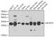 B Cell Receptor Associated Protein 31 antibody, GTX65823, GeneTex, Western Blot image 