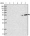 CUGBP Elav-Like Family Member 5 antibody, NBP1-89931, Novus Biologicals, Western Blot image 