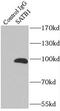 SATB Homeobox 1 antibody, FNab07615, FineTest, Immunoprecipitation image 