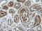 Formimidoyltransferase Cyclodeaminase antibody, M05499-2, Boster Biological Technology, Immunohistochemistry paraffin image 