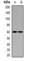 Atrial natriuretic peptide receptor 3 antibody, abx142052, Abbexa, Western Blot image 