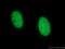 NOP2/Sun RNA Methyltransferase 2 antibody, 66580-1-Ig, Proteintech Group, Immunofluorescence image 
