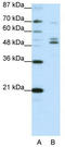 HNF-3-beta antibody, TA345339, Origene, Western Blot image 