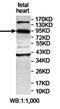 Apoptosis Resistant E3 Ubiquitin Protein Ligase 1 antibody, orb78173, Biorbyt, Western Blot image 