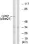 GRK1 antibody, LS-C199024, Lifespan Biosciences, Western Blot image 