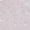 Kelch Like Family Member 24 antibody, HPA056337, Atlas Antibodies, Immunohistochemistry frozen image 