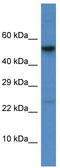 Dipeptidyl peptidase 1 antibody, TA342847, Origene, Western Blot image 