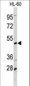 Decapping MRNA 2 antibody, LS-C167299, Lifespan Biosciences, Western Blot image 