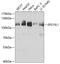 Epidermal growth factor receptor substrate 15-like 1 antibody, A02815, Boster Biological Technology, Western Blot image 