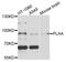 Phospholipase A2 Activating Protein antibody, STJ25018, St John