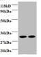 Mitochondrial Ribosomal Protein L9 antibody, A51837-100, Epigentek, Western Blot image 