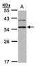 DNA repair protein XRCC2 antibody, TA308789, Origene, Western Blot image 