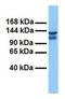 Chloride Voltage-Gated Channel 3 antibody, GTX47617, GeneTex, Western Blot image 